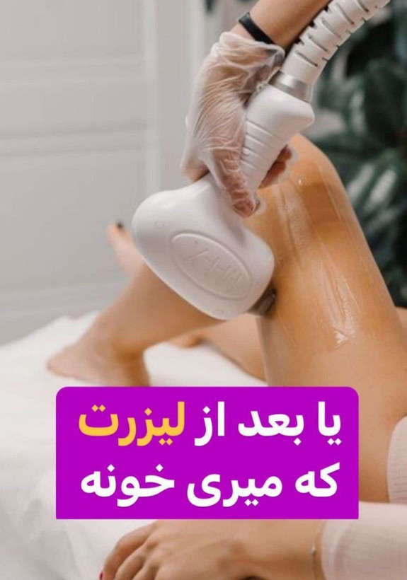اسپری جلوگیری از رشد موی زائد Sadoer (حاوی روغن مورچه )
