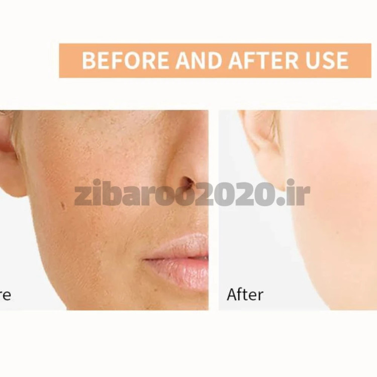کرم ضد آفتاب نیاسینامید لانبنا SPF 50 Lanbena Niacinamide Sunscreen SPF 50+ PA