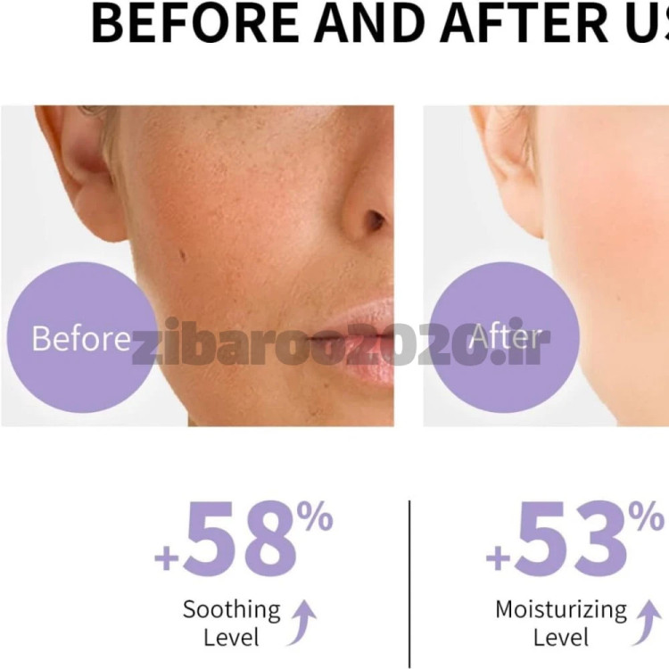 کرم ضد آفتاب شفاف کننده پوست لانبنا LANBENA Clear Skin Sunscreen