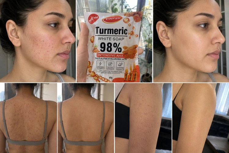صابون سفید کننده طلای زردچوبه turmeric
